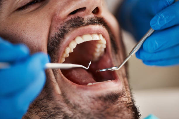 Best Same-Day Emergency Dentist in Perry, FL